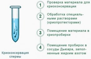 Криоконсервация спермы