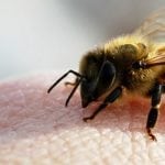 Пчелоужаливание: техника выполнения