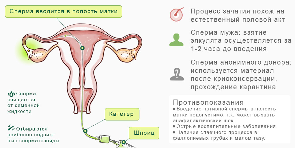 Есть ли зачатие. Половой акт и оплодотворение. Процесс зачатия. Процесс оплодотворения женщины.