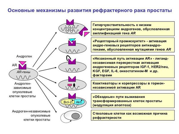 Рак простаты: что нужно знать
