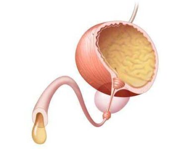 Заболевания мочеполовой системы у мужчин: симптомы и признаки