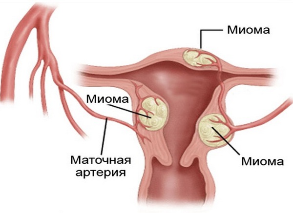 Гормонозаместительная терапия для мужчин: причины дефицита