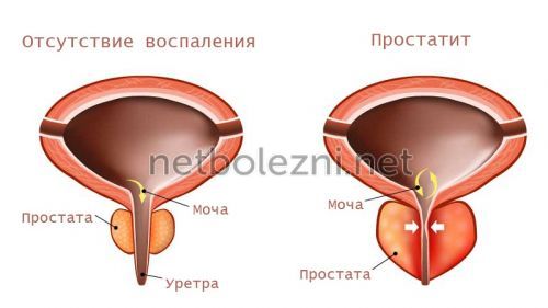 Омник окас аналоги дешевле